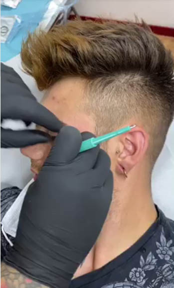 Piercing di Frank - LiberArte Studio Milano
